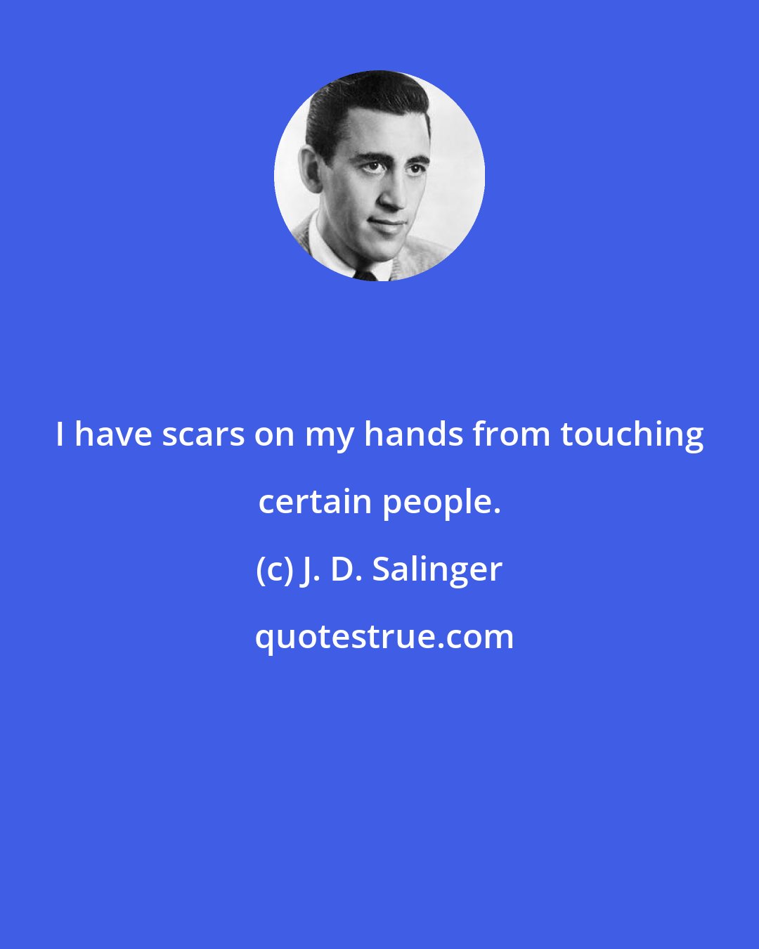 J. D. Salinger: I have scars on my hands from touching certain people.