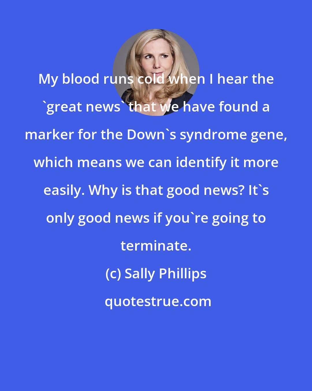Sally Phillips: My blood runs cold when I hear the 'great news' that we have found a marker for the Down's syndrome gene, which means we can identify it more easily. Why is that good news? It's only good news if you're going to terminate.