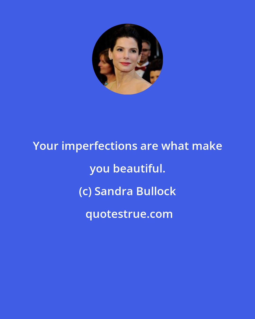 Sandra Bullock: Your imperfections are what make you beautiful.