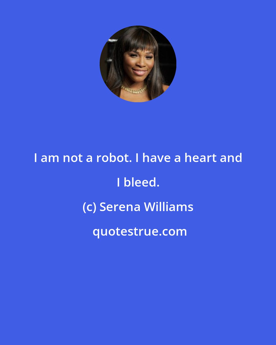 Serena Williams: I am not a robot. I have a heart and I bleed.