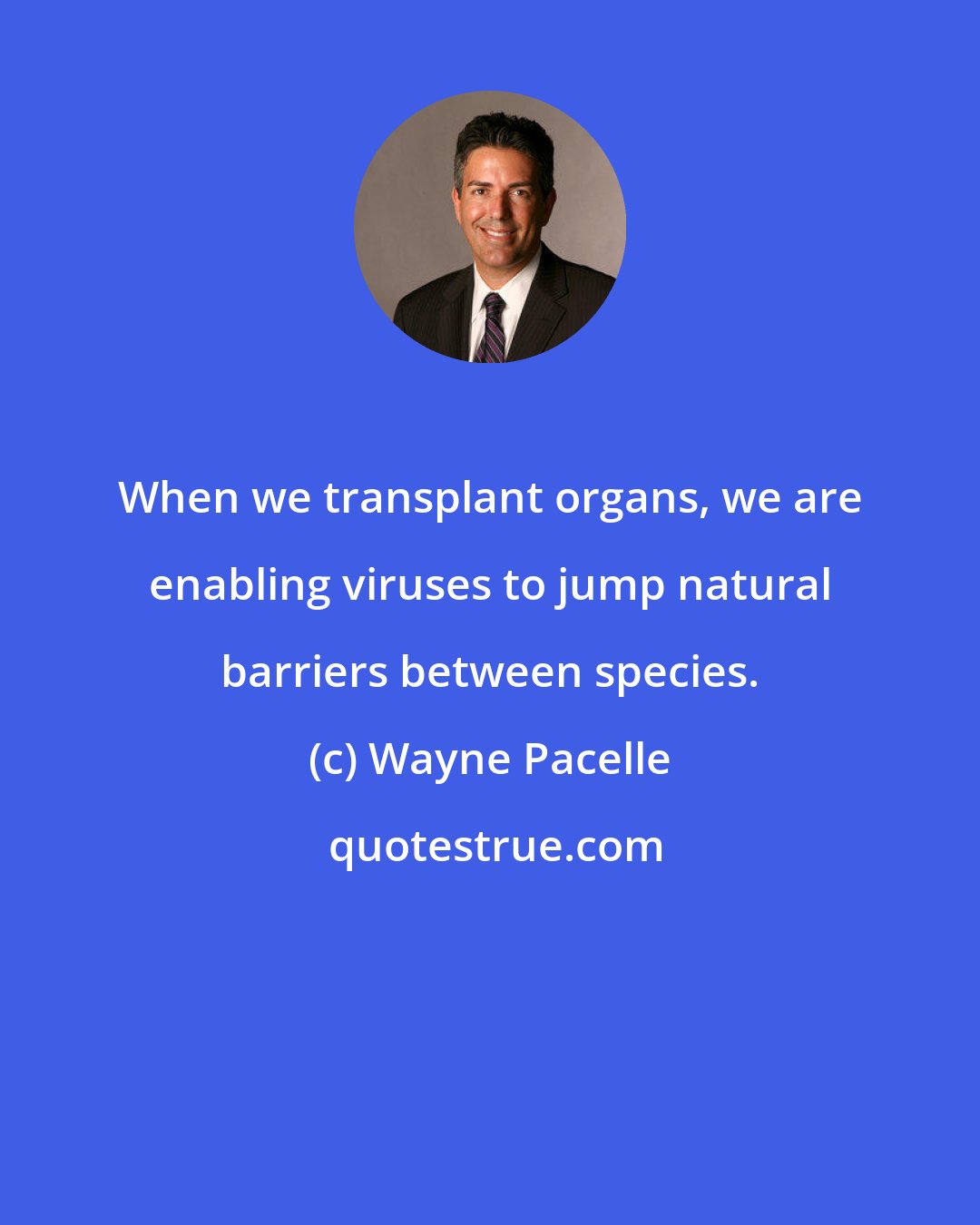 Wayne Pacelle: When we transplant organs, we are enabling viruses to jump natural barriers between species.