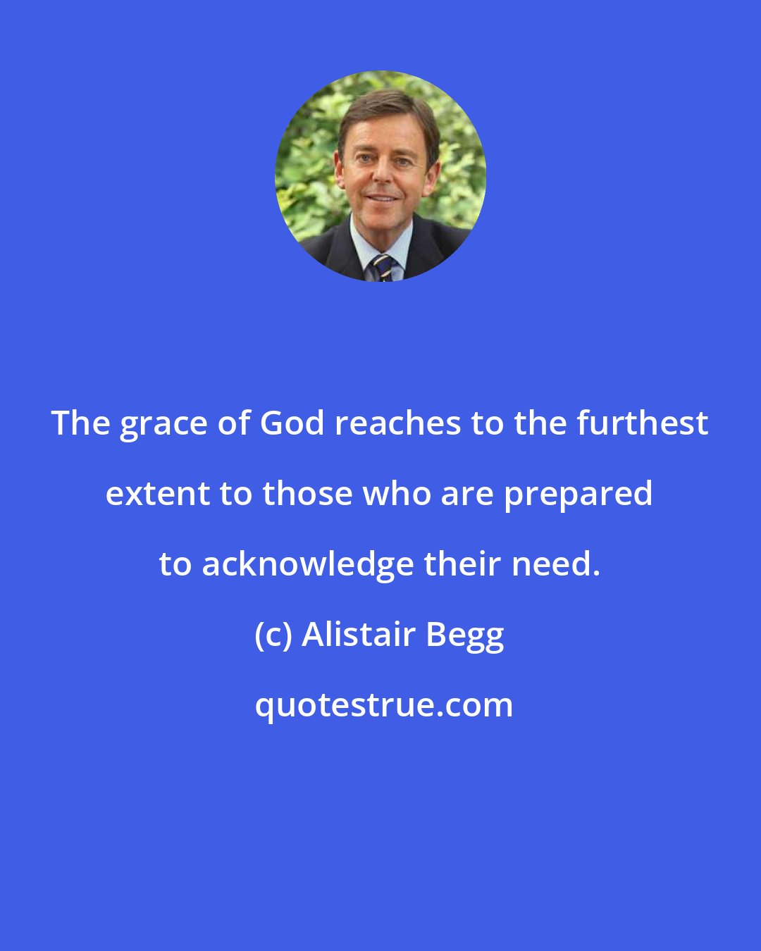 Alistair Begg: The grace of God reaches to the furthest extent to those who are prepared to acknowledge their need.