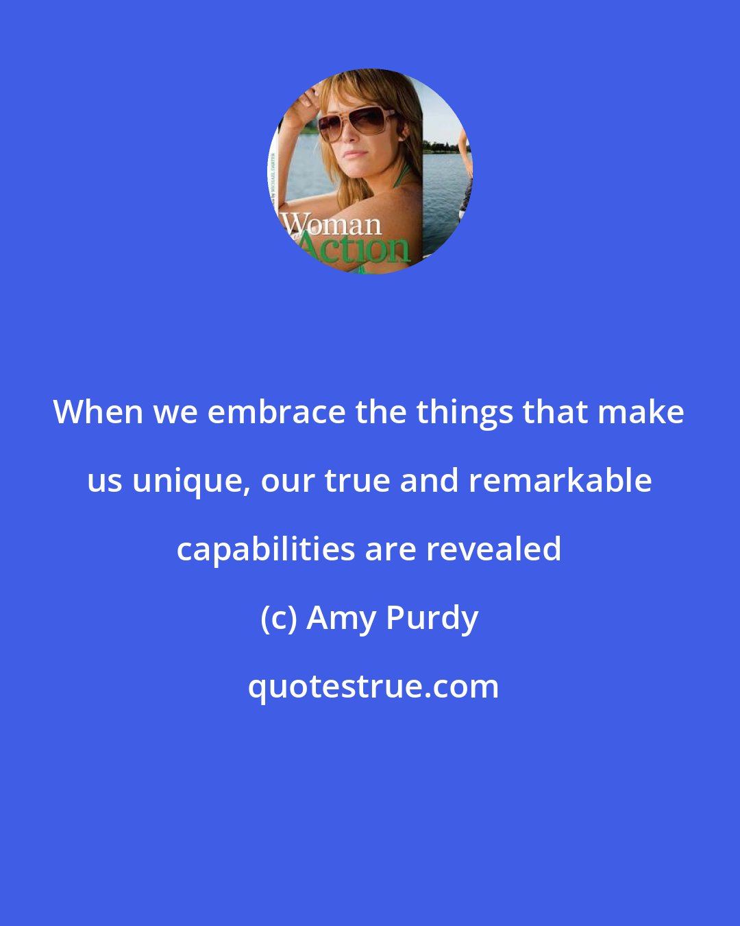 Amy Purdy: When we embrace the things that make us unique, our true and remarkable capabilities are revealed