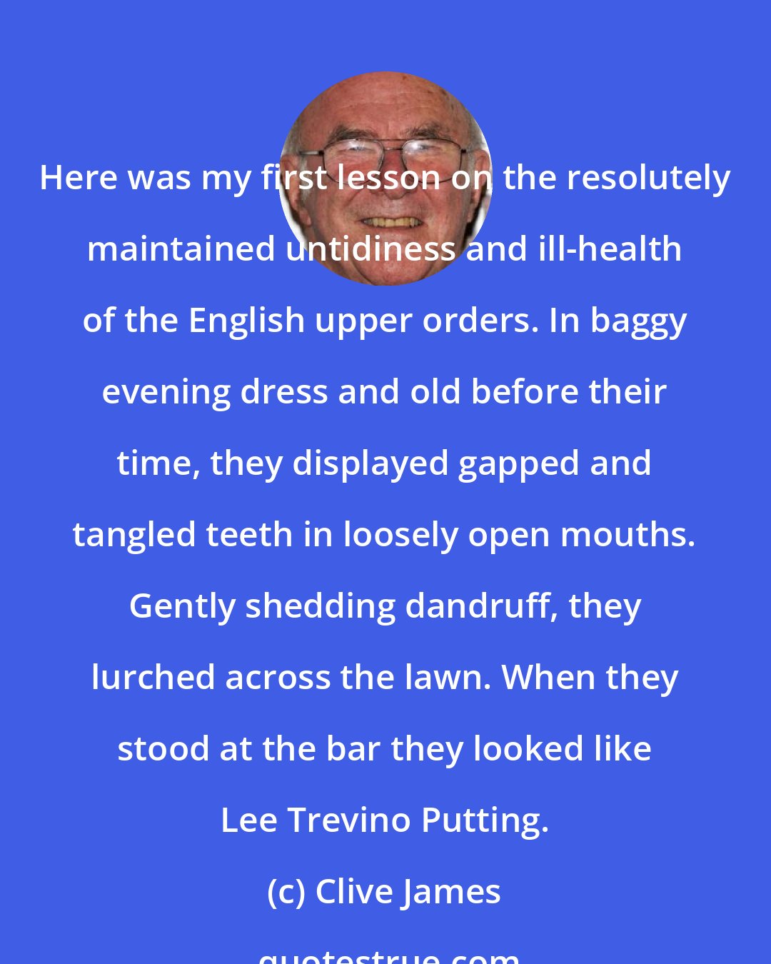 Clive James: Here was my first lesson on the resolutely maintained untidiness and ill-health of the English upper orders. In baggy evening dress and old before their time, they displayed gapped and tangled teeth in loosely open mouths. Gently shedding dandruff, they lurched across the lawn. When they stood at the bar they looked like Lee Trevino Putting.