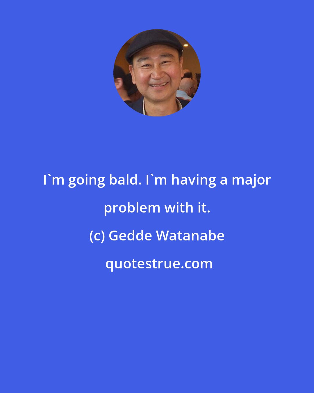 Gedde Watanabe: I'm going bald. I'm having a major problem with it.