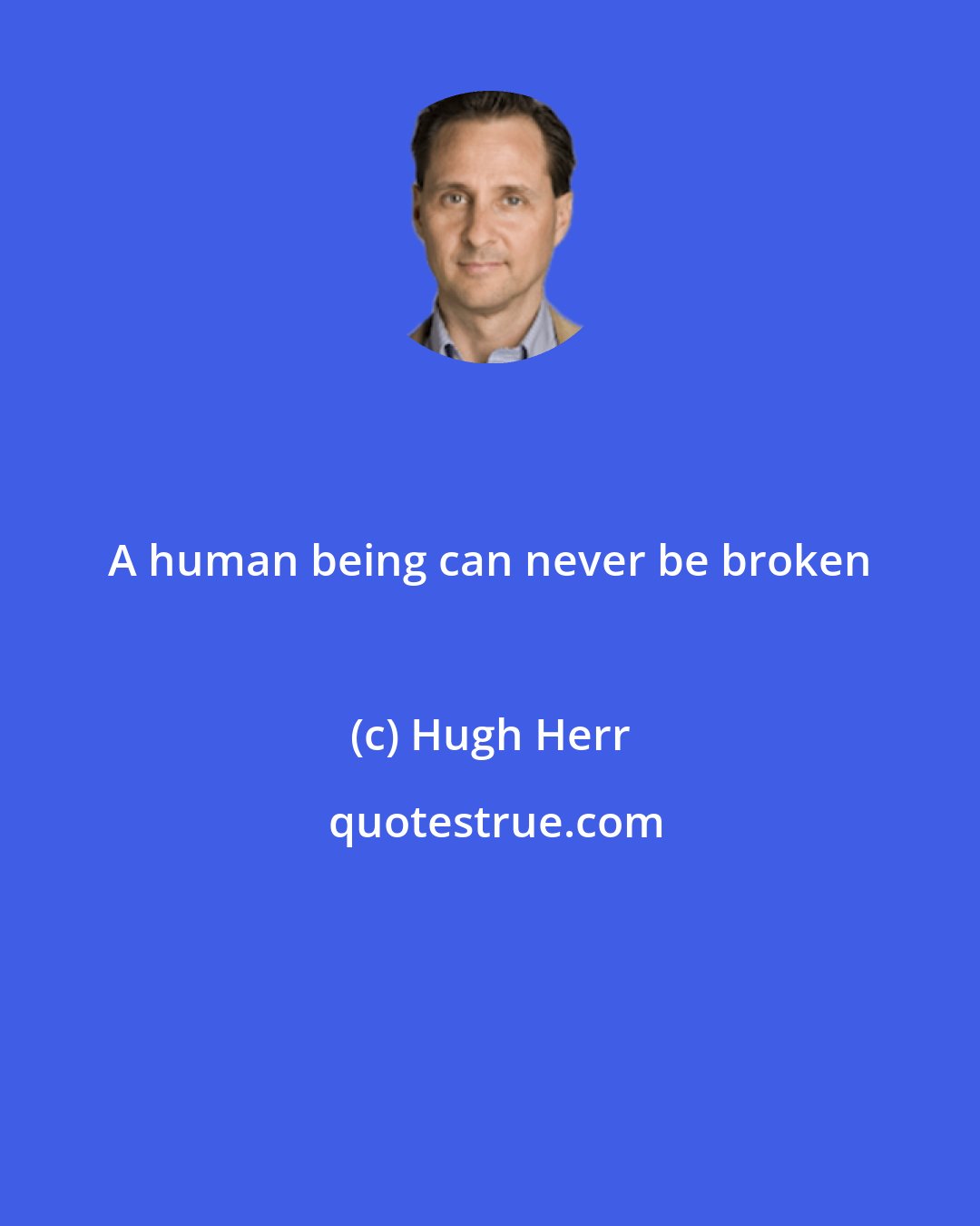 Hugh Herr: A human being can never be broken