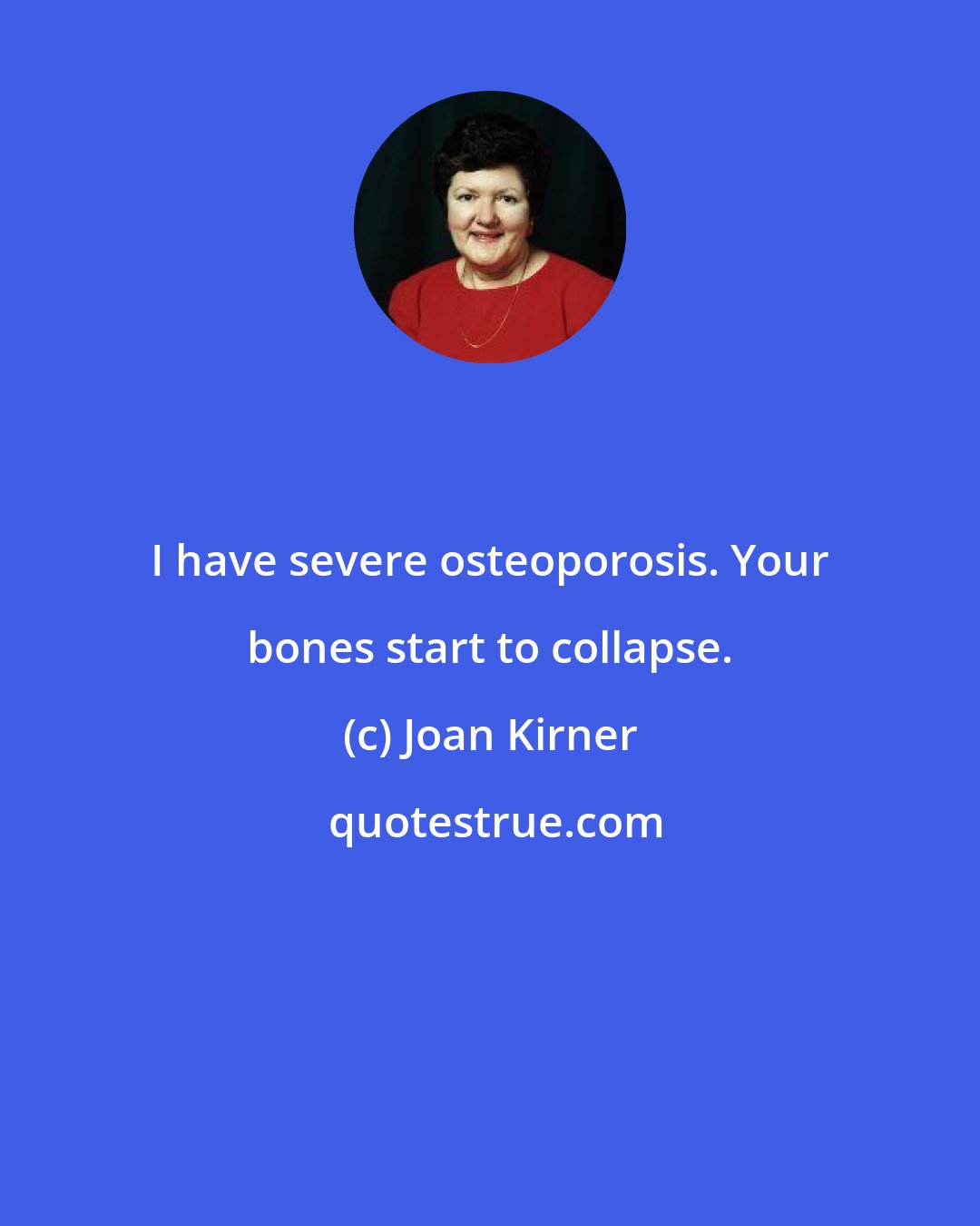 Joan Kirner: I have severe osteoporosis. Your bones start to collapse.